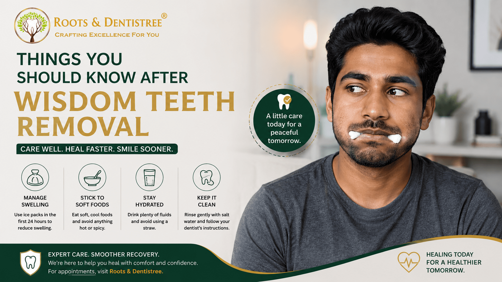 Things To Know Post Wisdom Teeth Extraction @ROOTS DENTISTREE