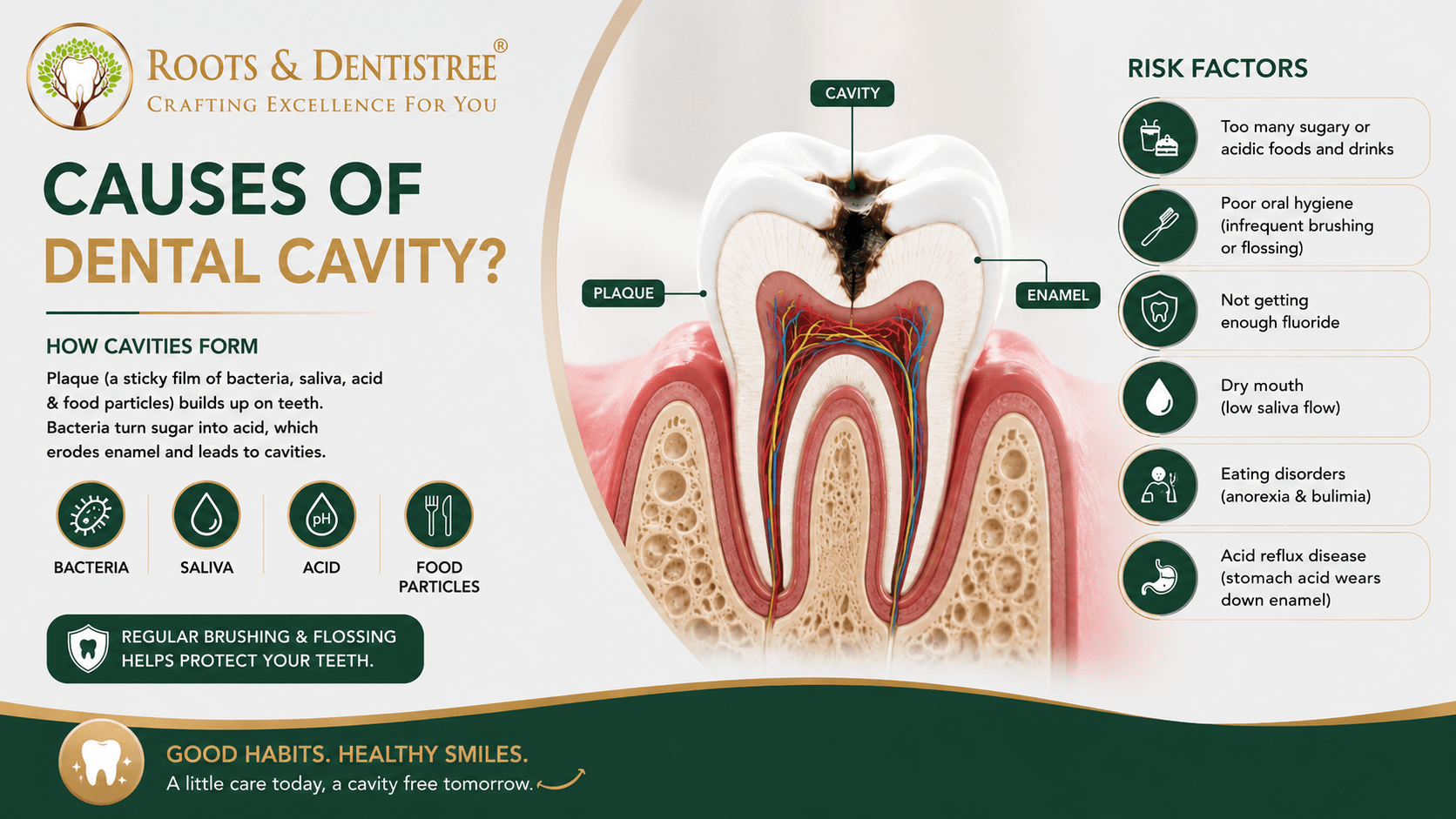 CAUSES OF DENTAL CAVITY@ ROOTS & DENTISTREE