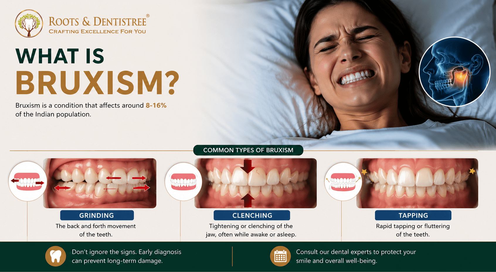 WHAT IS BRUXISM@ ROOTS & DENTISTREE