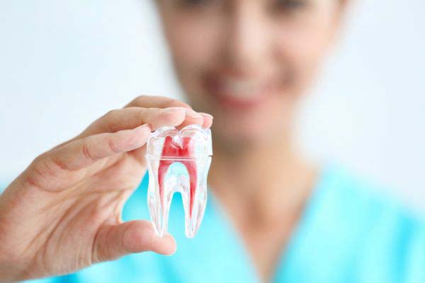 Your Top Questions Related To Root Canal Treatment