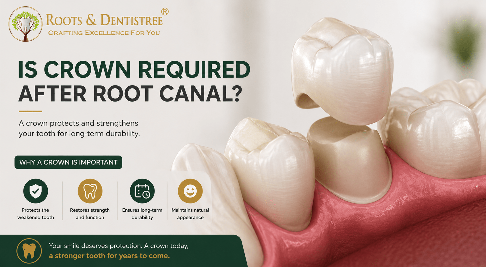 CROWN AFTER ROOT CANAL@ ROOTS & DENTISTREE