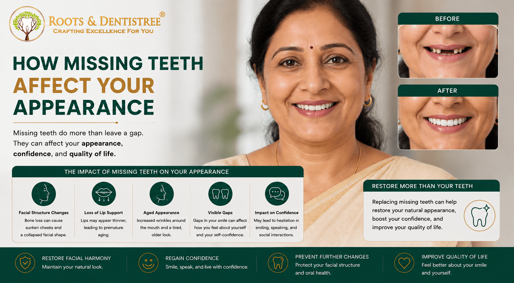 Effect of Appearance Due to Missing Teeth @ ROOTS DENTISTREE