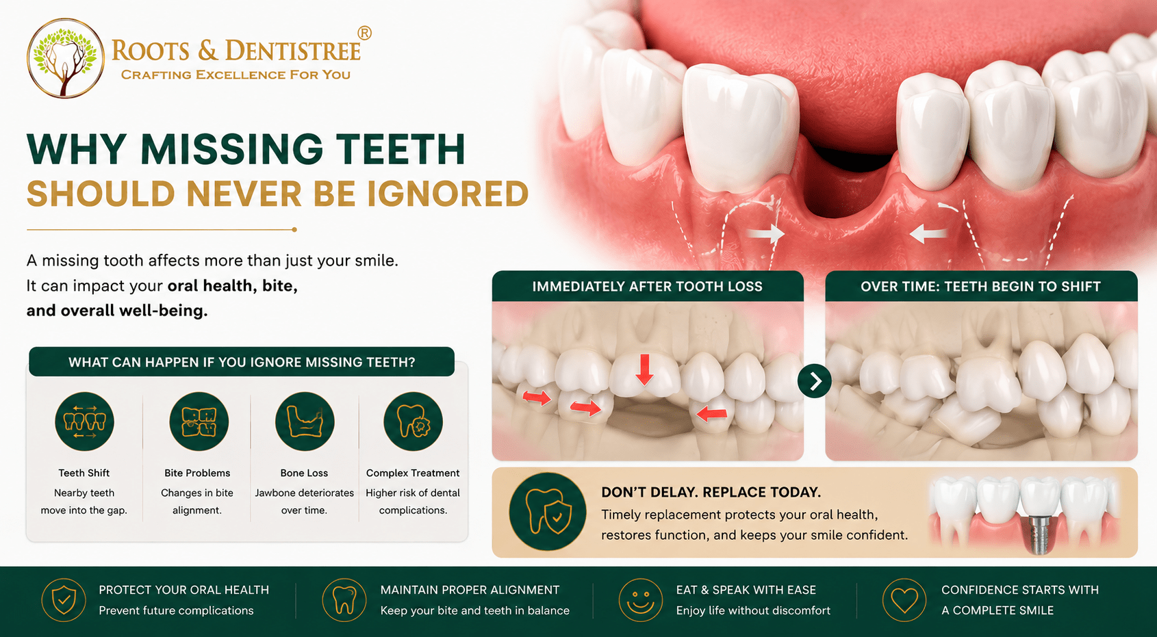 Infographic about why missing teeth should not be ignored, showing a jaw illustration with gaps and consequences and a two-panel comparison.