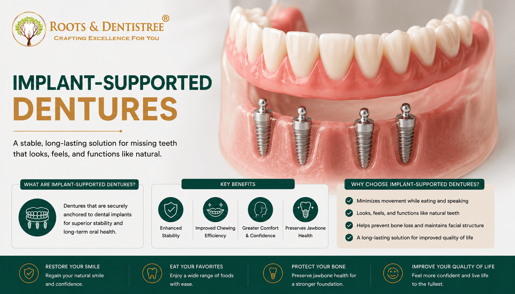 Infographic for Roots & Dentistree about implant-supported dentures, showing a jaw model with four dental implants and descriptive text panels about benefits and reasons to choose them.