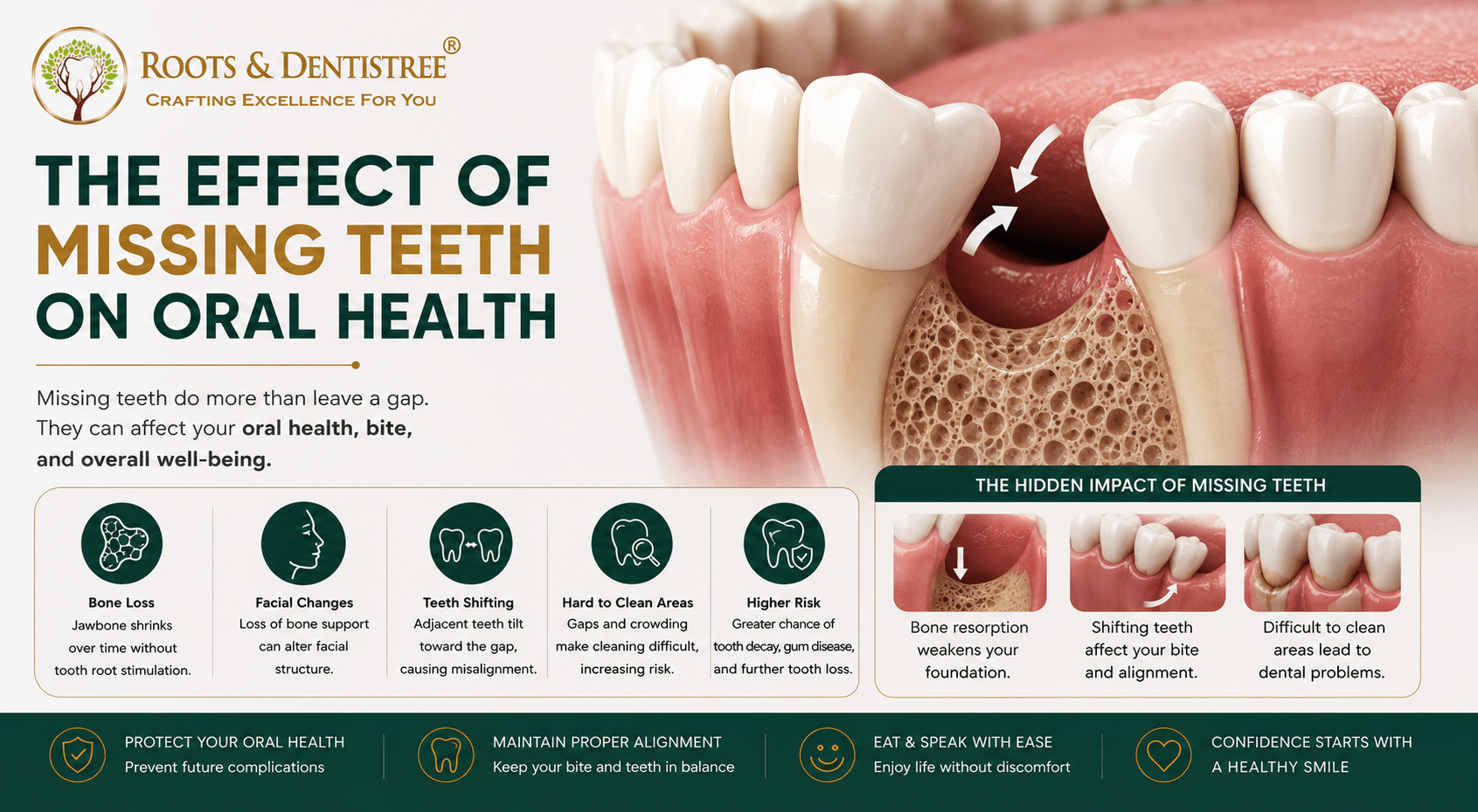 Infographic about missing teeth and their effects on oral health, with a diagram of bone loss and consequence icons.