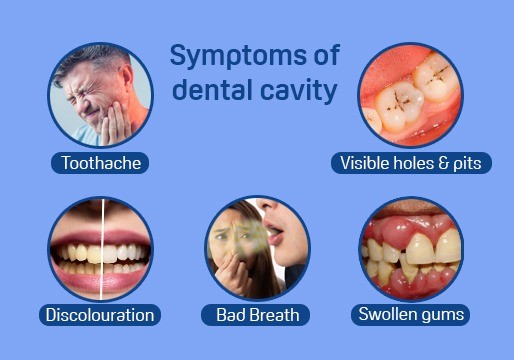 Symptoms of a Dental Cavity