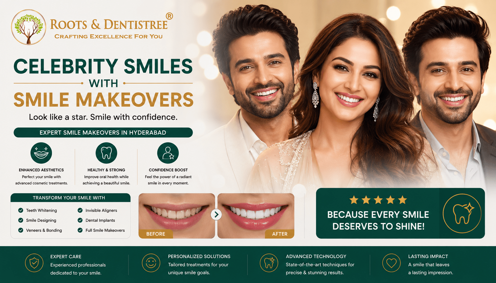 CELEBRITY SMILES WITH SMILE MAKEOVERS@ ROOTS & DENTISTREE