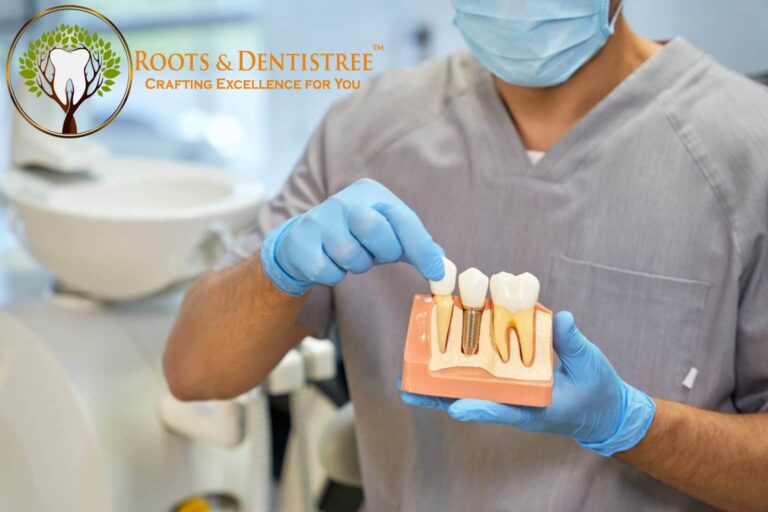 Dental Implants: What to Know?