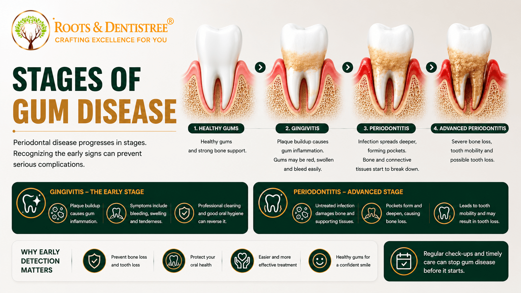 Infographic showing the four stages of gum disease from healthy gums to advanced periodontitis with tooth illustrations and short descriptions.