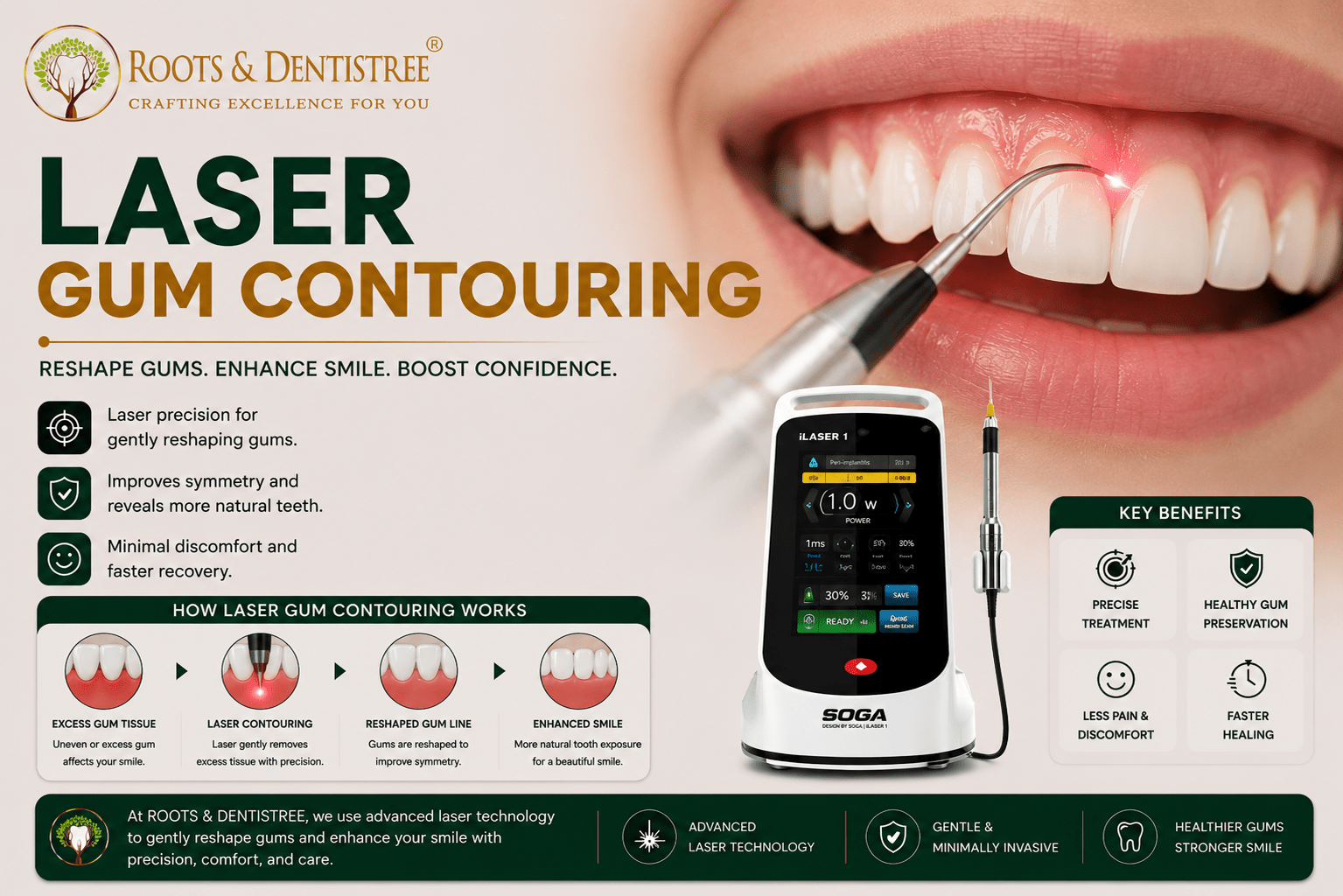 LASER GUM CONTOURING @ROOTS & DENTISTREE