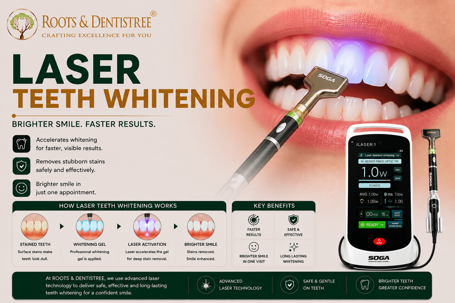 LASER TEETH WHITENING @ROOTS & DENTISTREE