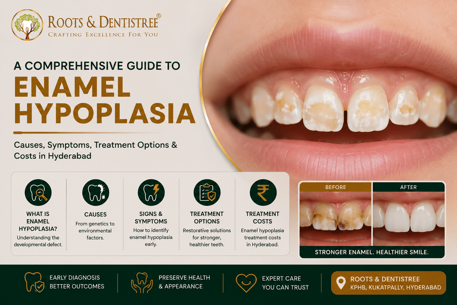 COMPREHENSIVE GUIDE TO ENAMEL HYPOPLASIA@ ROOTS & DENTISTREE