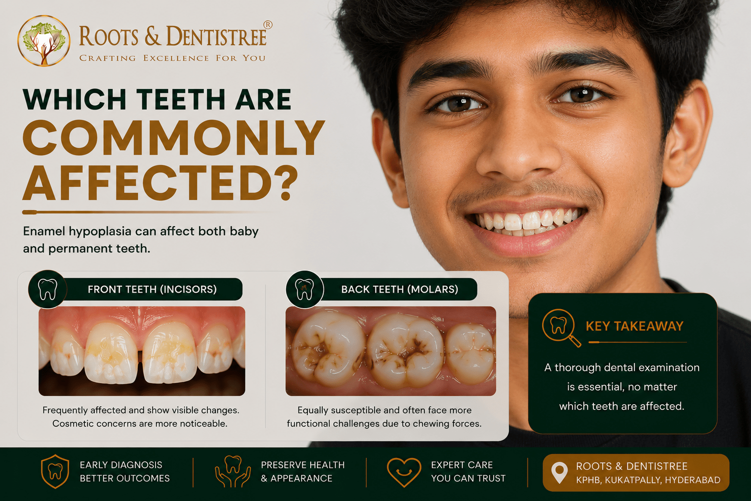 Roots & Dentistree ad: smiling teen with text 'Which teeth are commonly affected?' and two panels showing front teeth and back teeth health visuals.