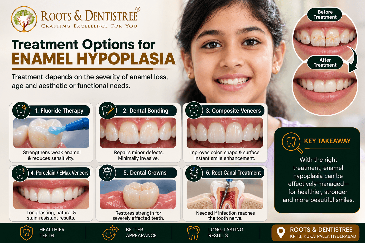 Infographic promoting enamel hypoplasia treatments by Roots & Dentistree, showing six options and before/after smile photos.