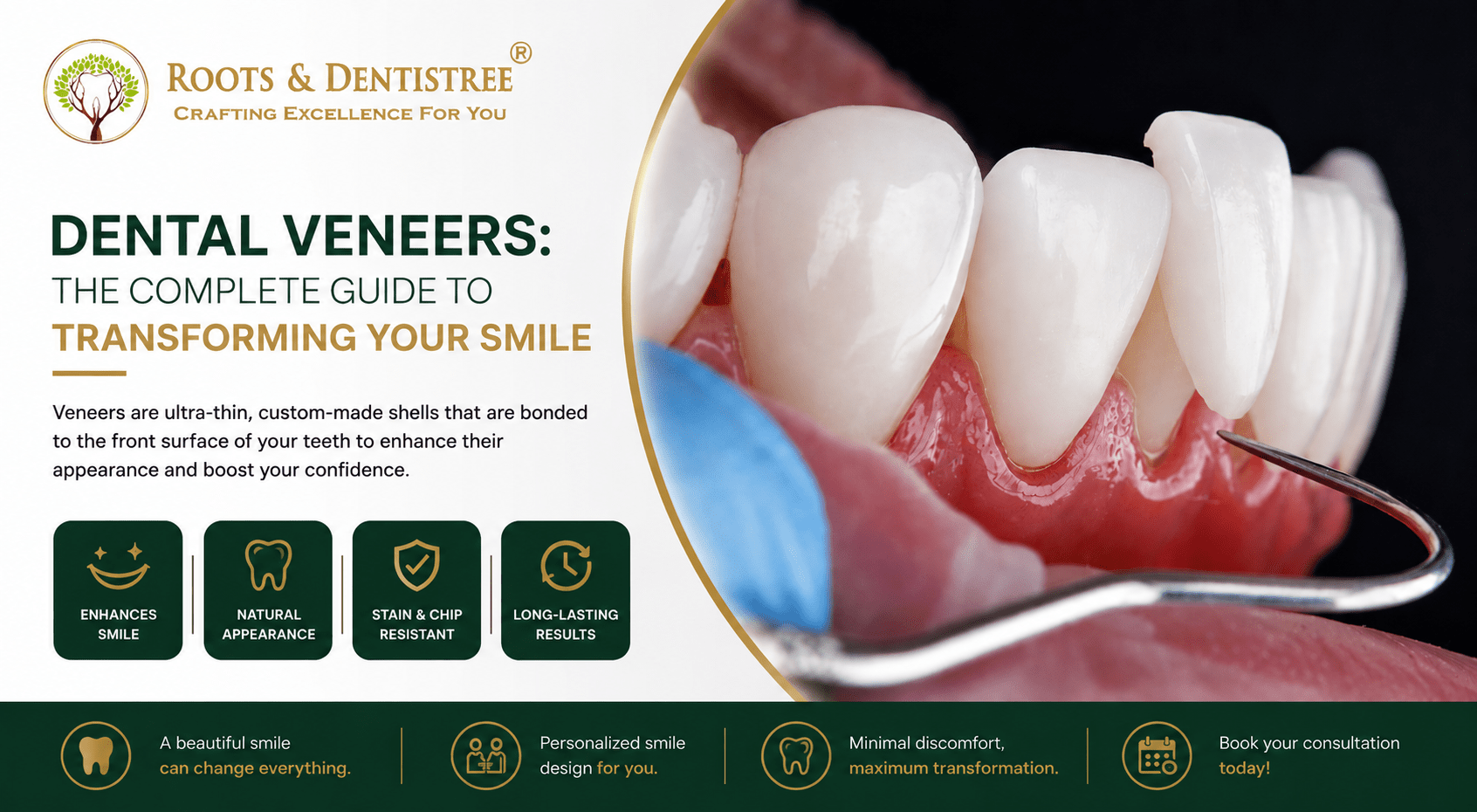 Dental Veneers @ ROOTS & DENTISTREE