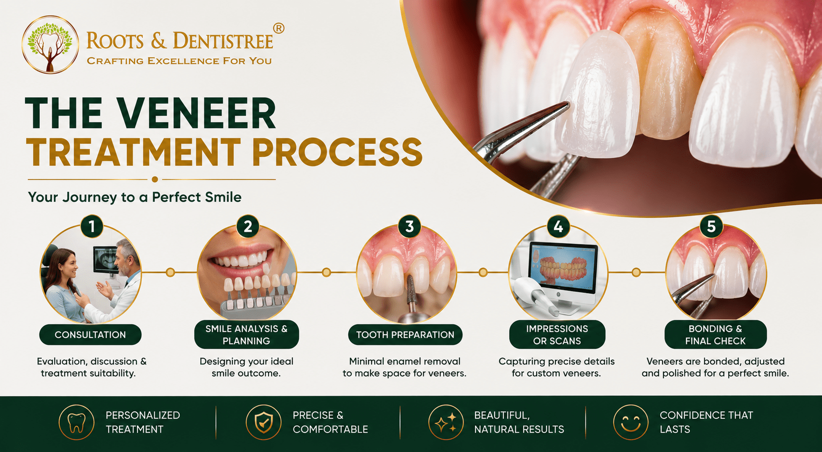 VENEERS TREATMENT PROCESS@ ROOTS & DENTISTREE