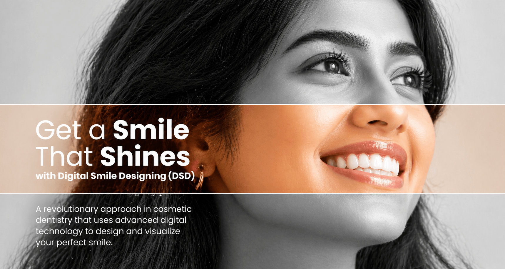 DIGITAL SMILE DESIGNING @ ROOTS & DENTISTREE