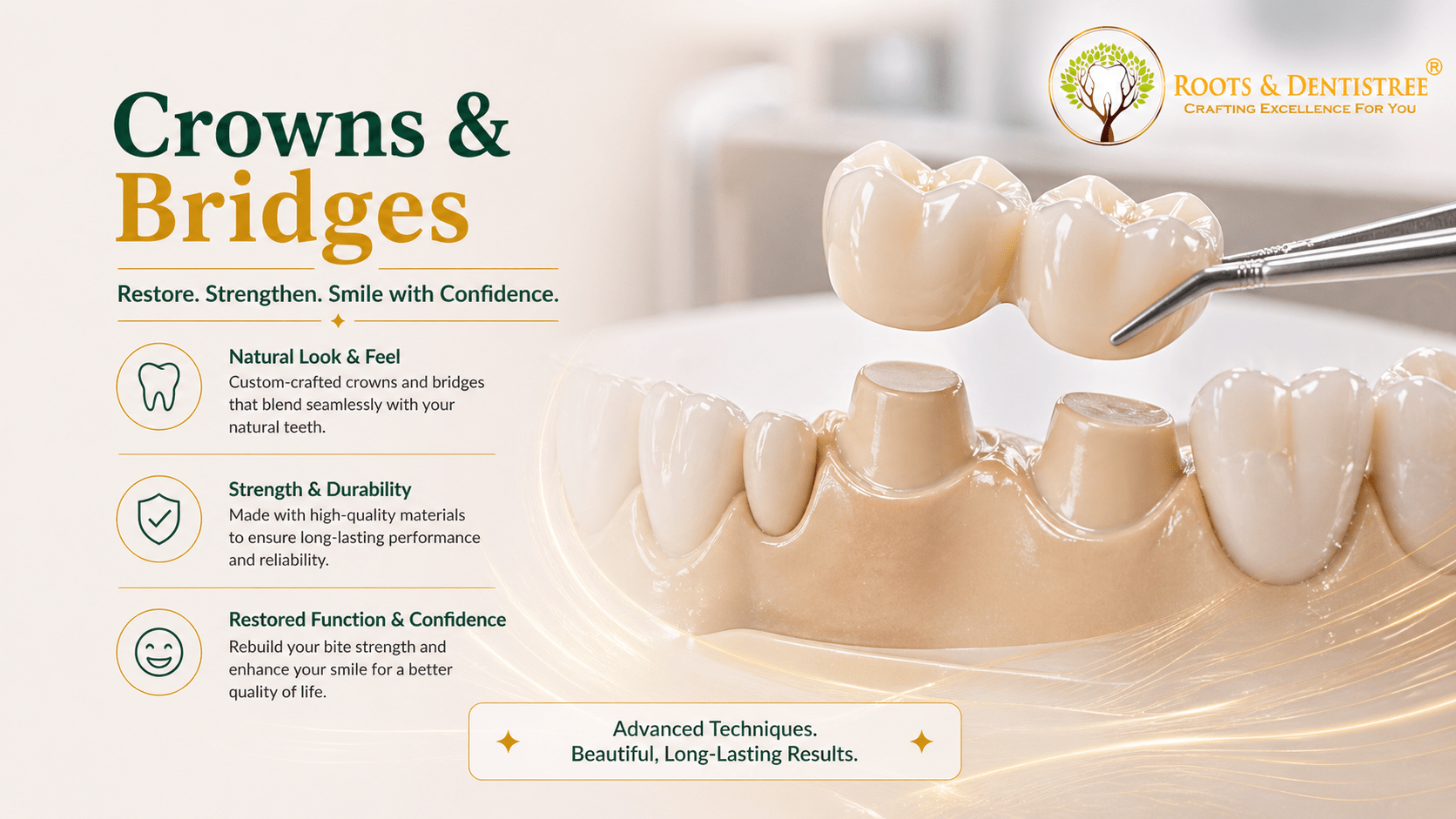 Crowns & Bridges @Roots & Dentistree