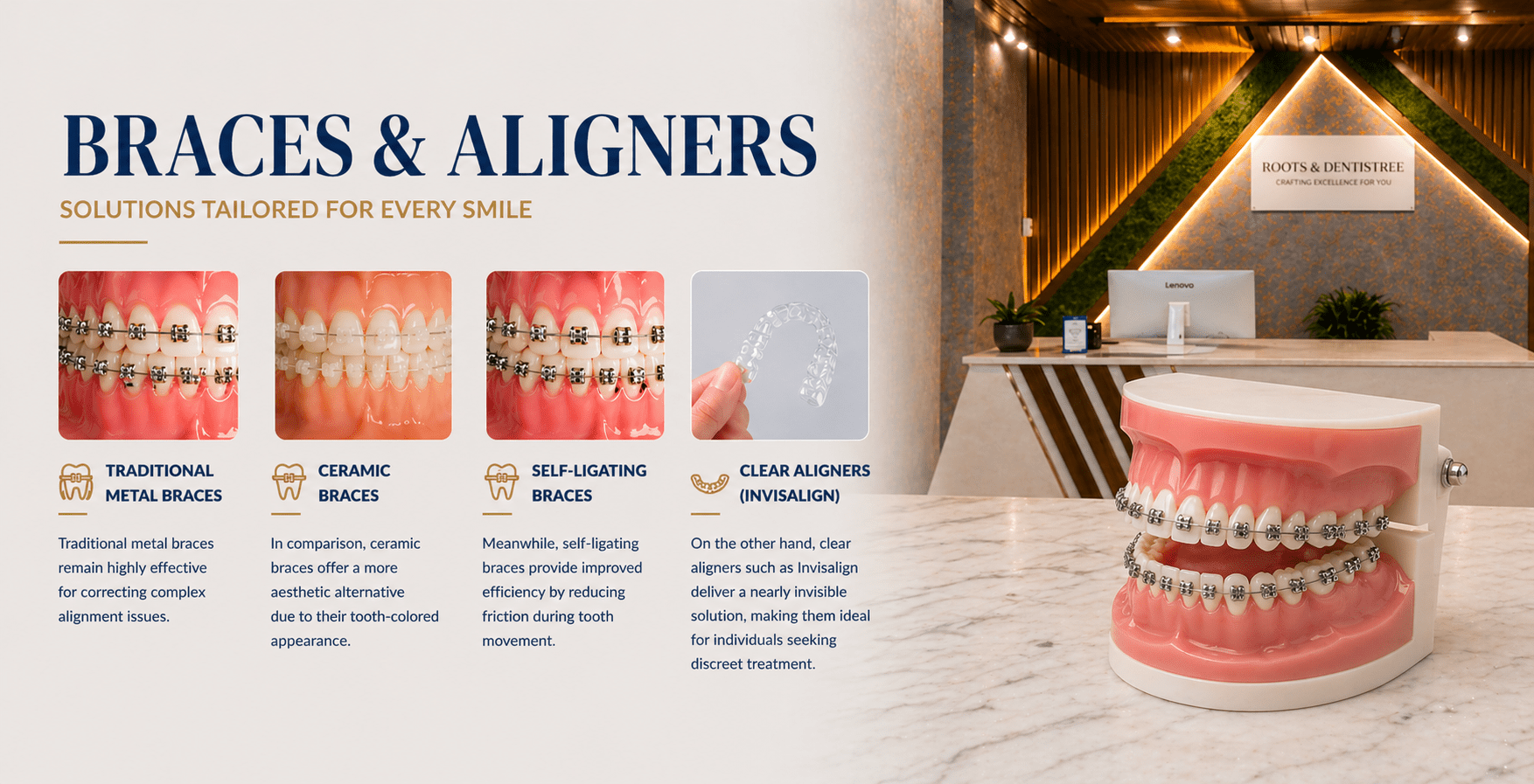 Types Of Orthodontic Treatment@ ROOTS & DENTISTREE