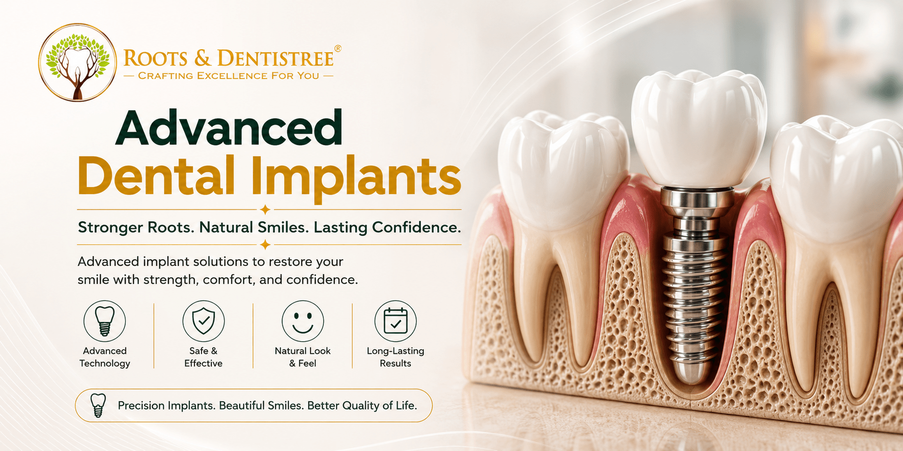 ADVANCED DENTAL IMPLANTS @ ROOTS & DENTISTREE