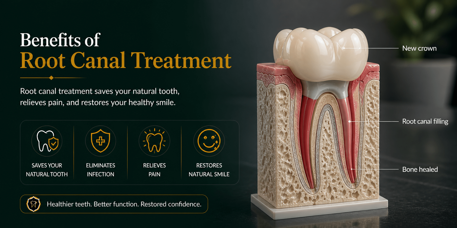 Informative graphic about root canal treatment: highlights benefits and a cross-section tooth model labeled new crown, root canal filling, and bone healing.