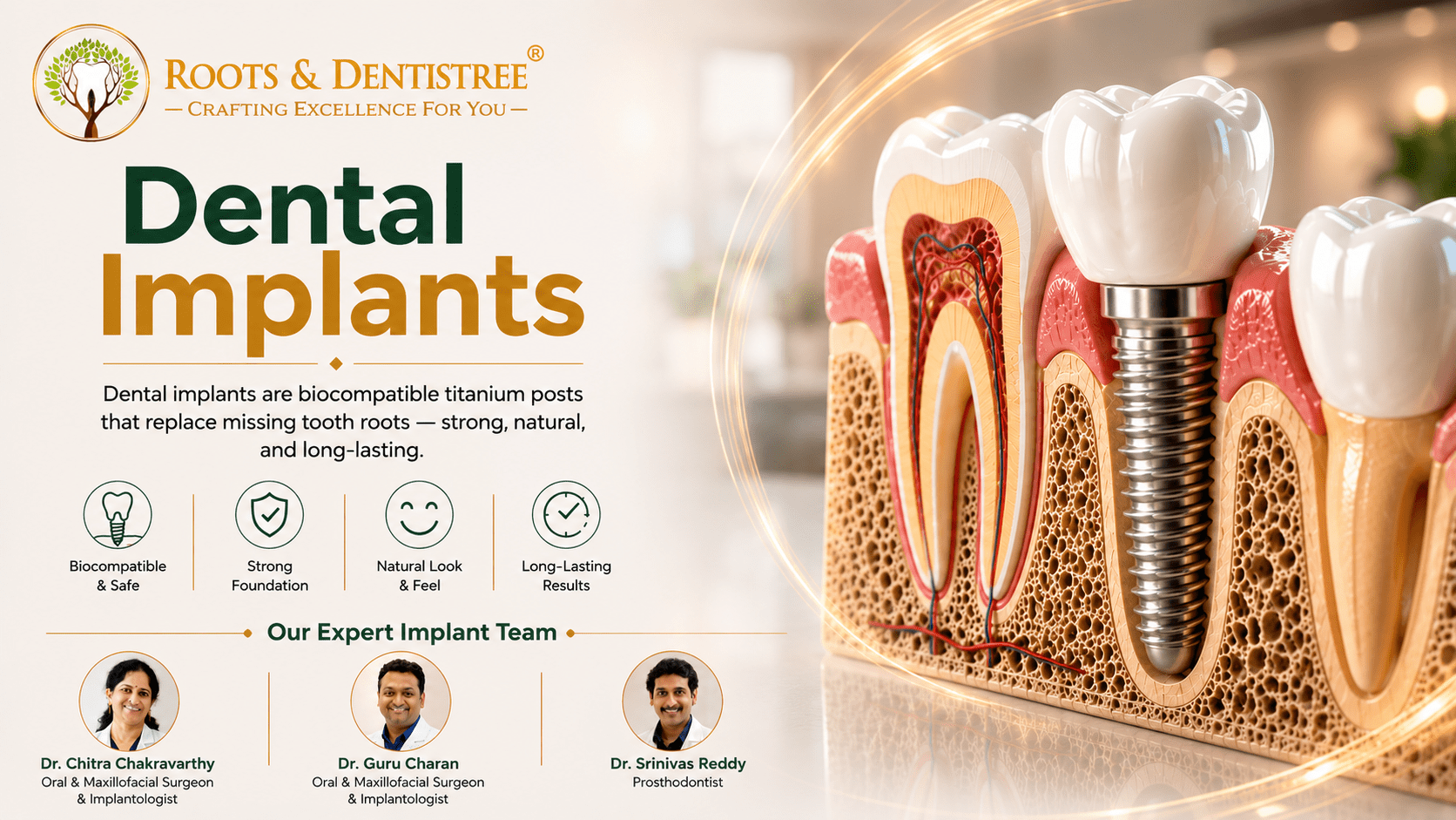 DENTAL IMPLANTS & EXPERT TEAM @ ROOTS & DENTISTREE