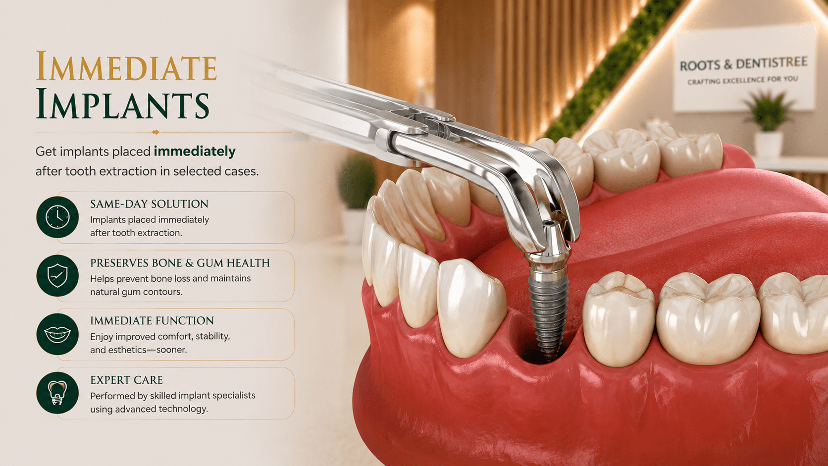 immediate implants@ ROOTS & DENTISTREE