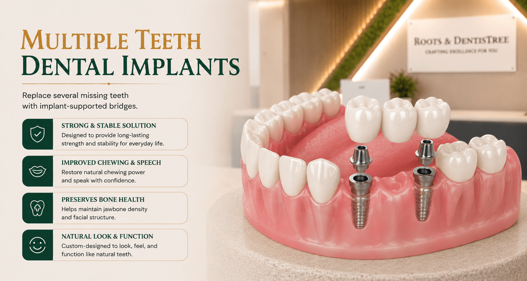 multiple-teeth dental implants@ ROOTS & DENTISTREE