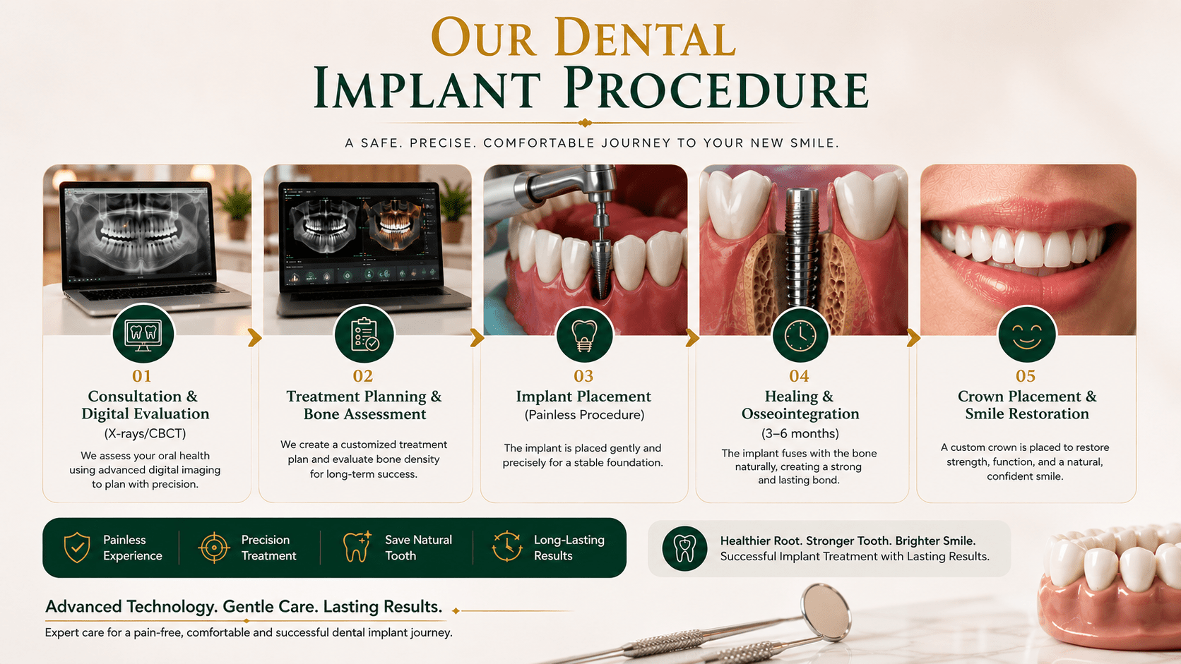 OUR DENTAL IMPLANT PROCEDURE @ ROOTS & DENTISTREE