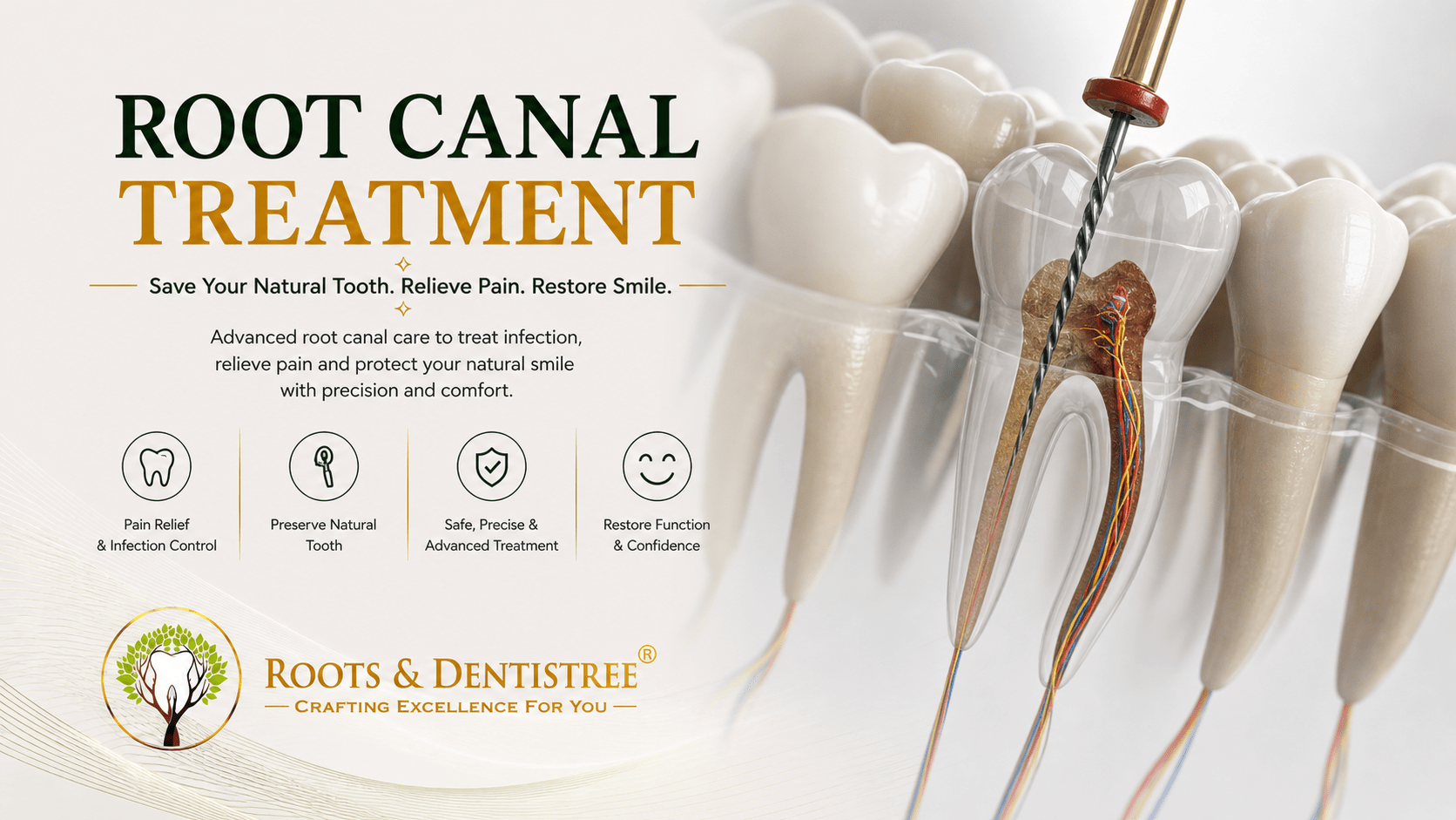 Root Canal Treatment@ ROOTS & DENTISTREE