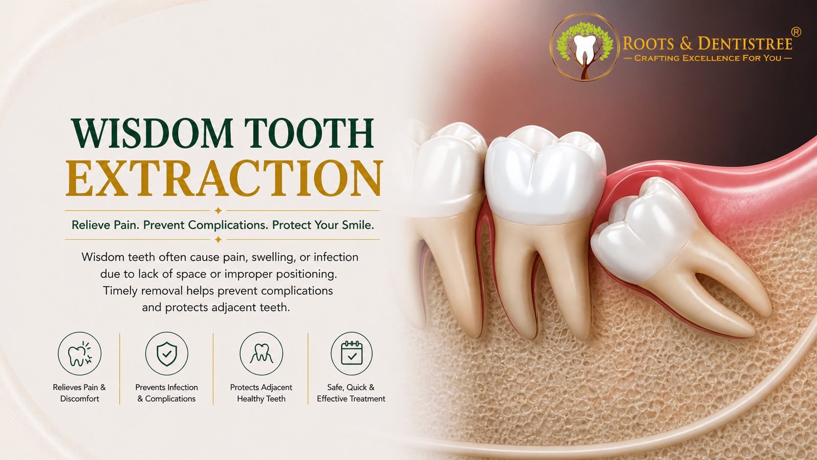 WISDOM TOOTH EXTRACTION @ ROOTS & DENTISTREE
