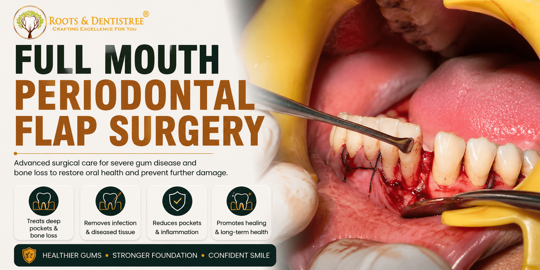 Banner ad for Roots & Dentistre showing a dental procedure with sutures during full-mouth periodontal flap surgery.
