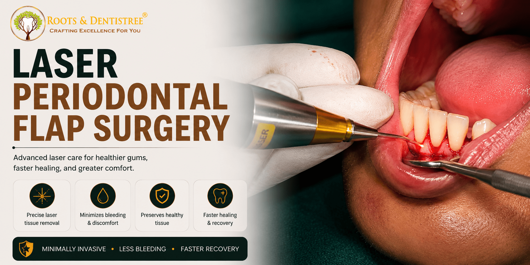 Promotional banner for laser periodontal flap surgery showing a dental laser procedure inside a patient’s mouth with branding in the top left.