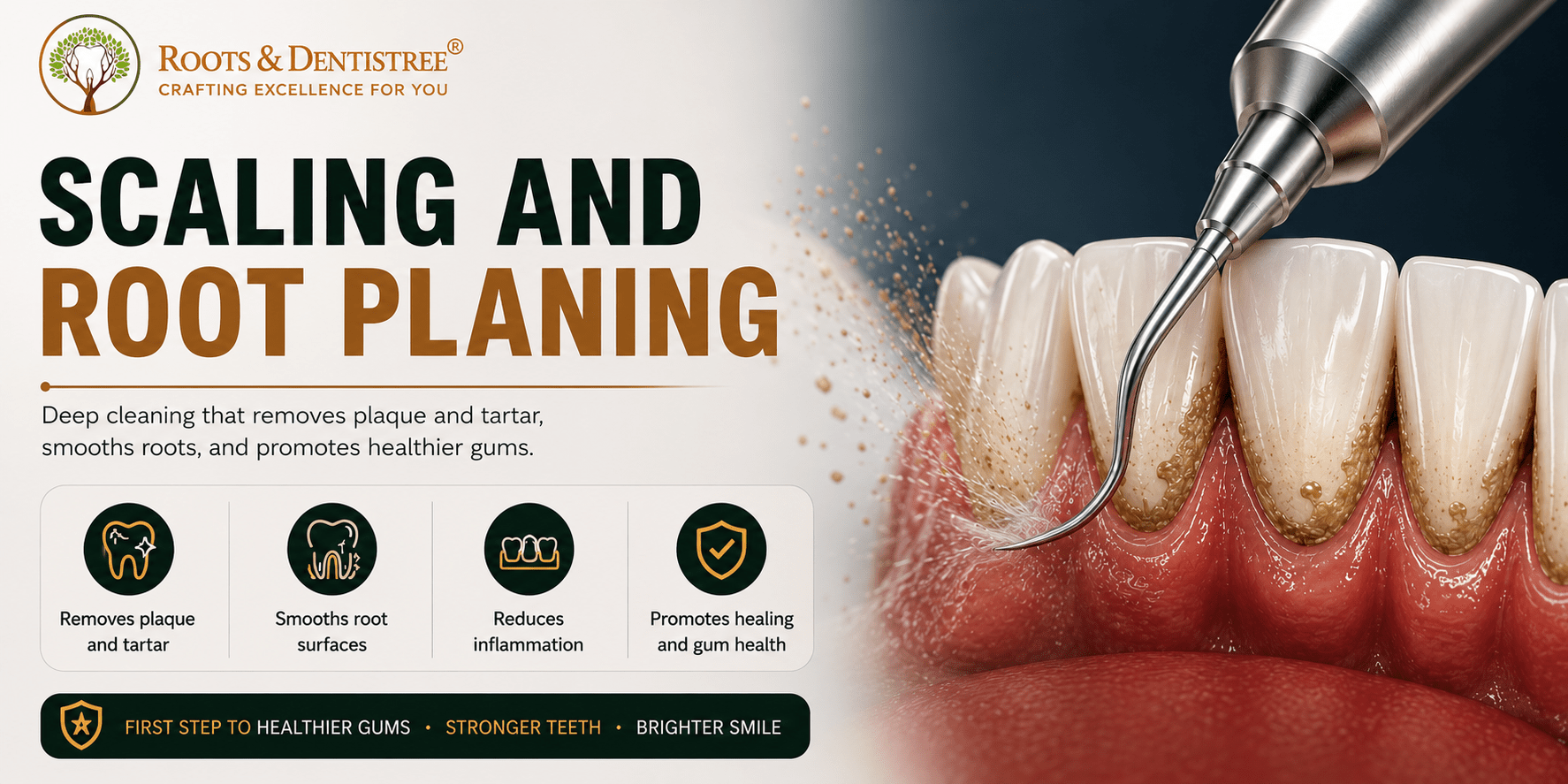 Close-up of a dental scaler cleaning teeth and gums beside a header that reads 'Scaling and Root Planing'.